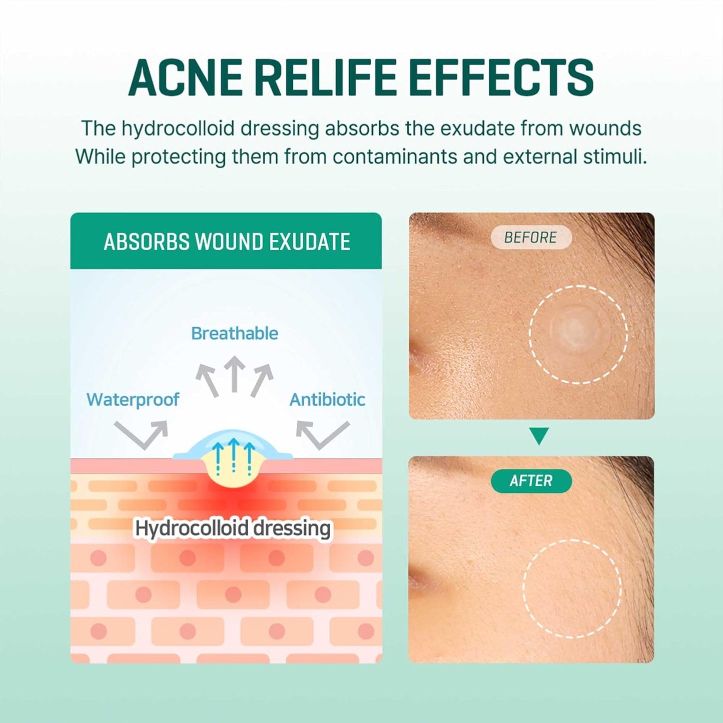 SOME BY MI Clear Spot Patch